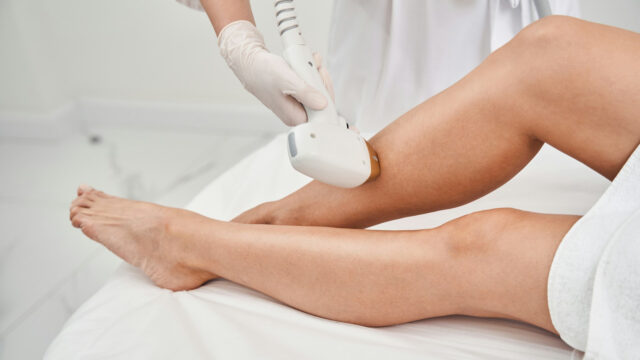 Sessão de depilação a laser sendo realizada nas pernas, garantindo uma pele lisa e sem pelos de forma duradoura.